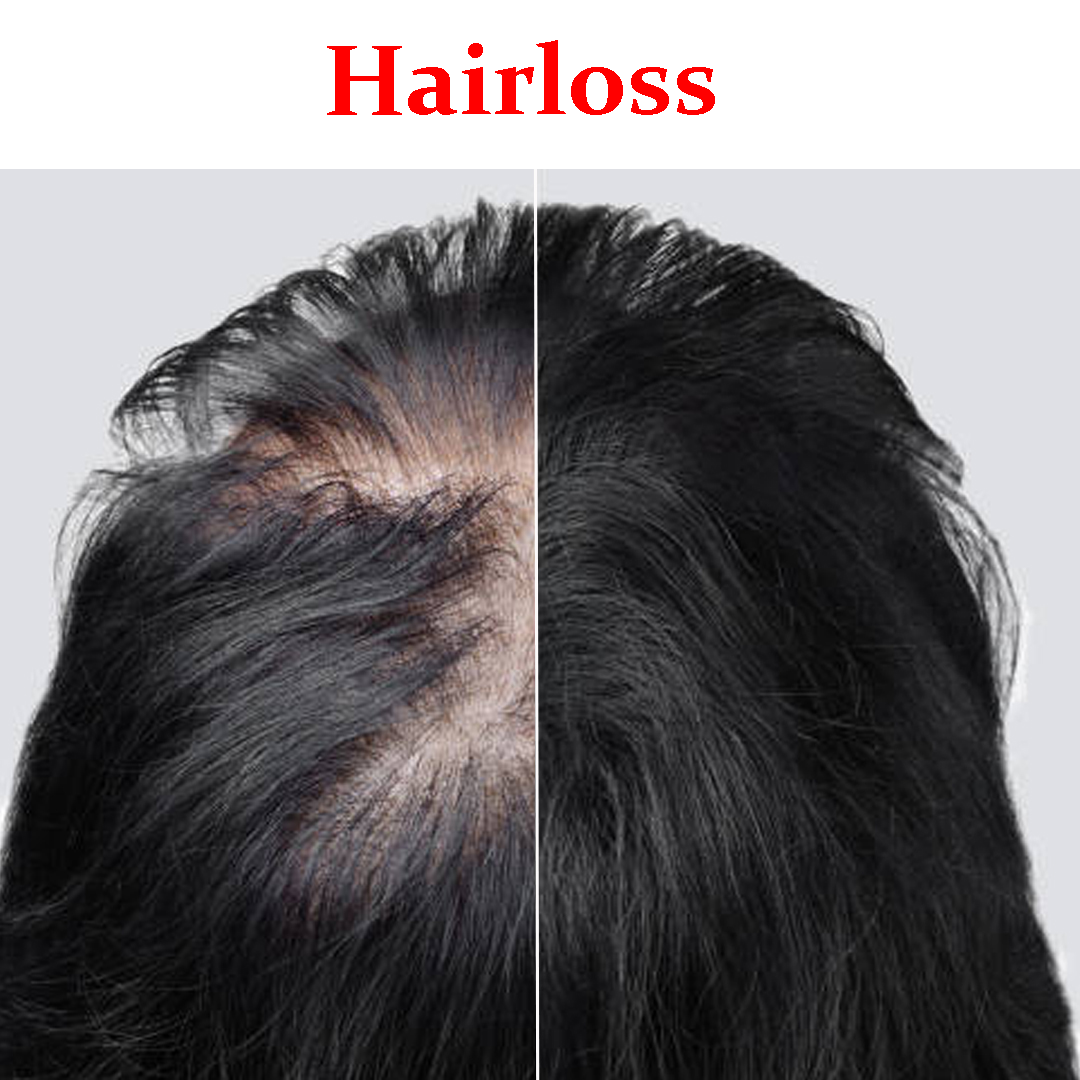 Hair Loss Product Box