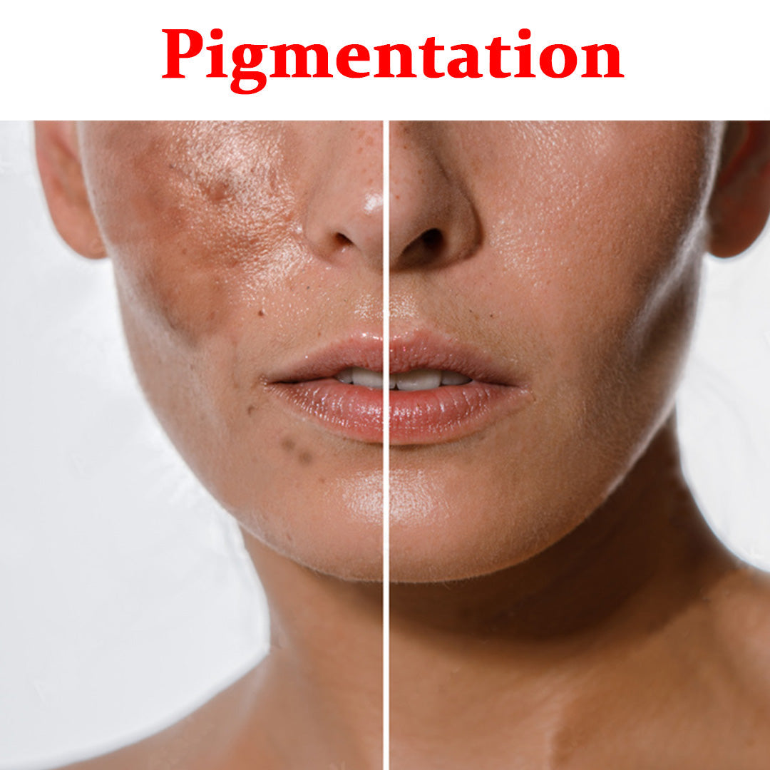 Hyper-Pigmentation Product Box