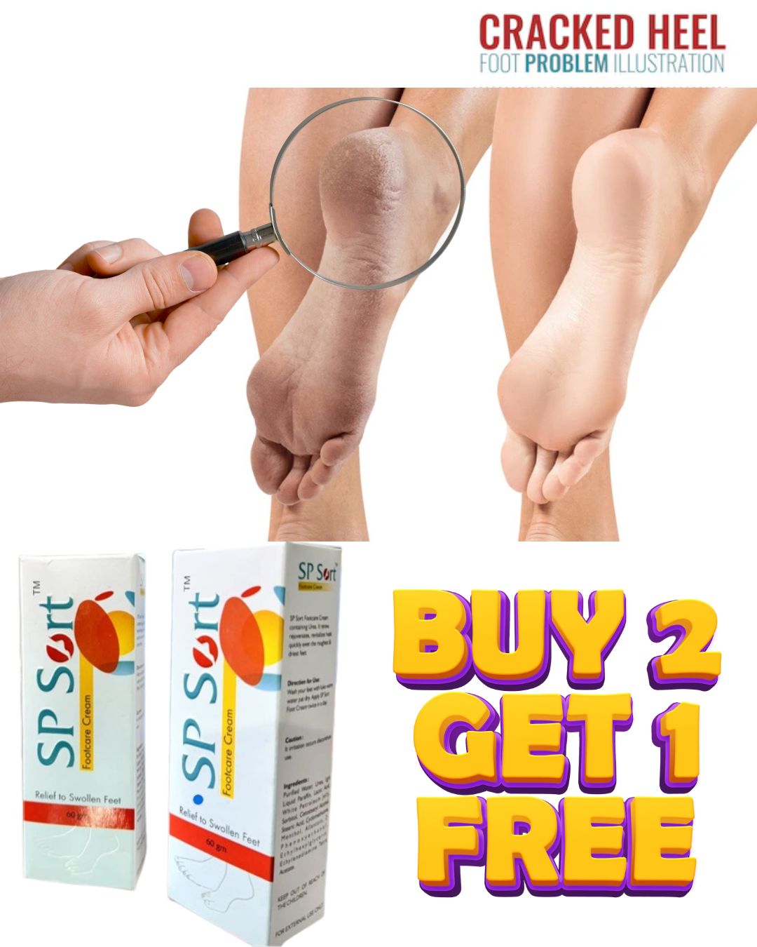 SP SORT Footcare Cream