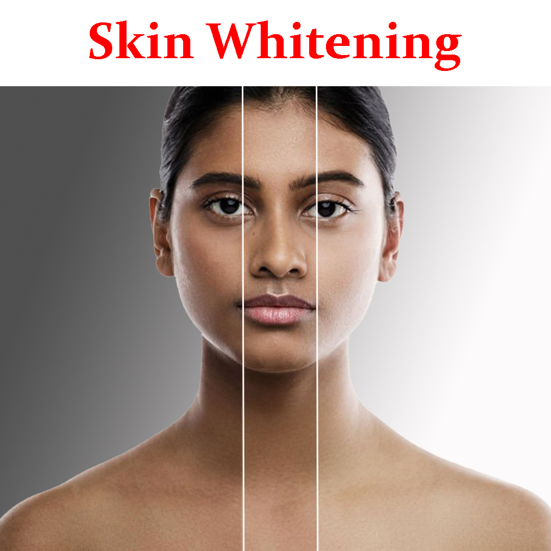 Skin Whitening